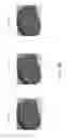 Fig. 101 - Patient-adapted and improved articular implants, designs and related guide tools