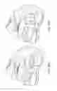 Fig. 121 - Patient-adapted and improved articular implants, designs and related guide tools