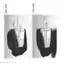 Fig. 124 - Patient-adapted and improved articular implants, designs and related guide tools