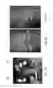 Fig. 13 - Patient-adapted and improved articular implants, designs and related guide tools