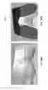 Fig. 130 - Patient-adapted and improved articular implants, designs and related guide tools