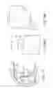 Fig. 136 - Patient-adapted and improved articular implants, designs and related guide tools