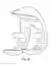 Fig. 137 - Patient-adapted and improved articular implants, designs and related guide tools