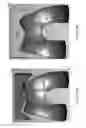 Fig. 149 - Patient-adapted and improved articular implants, designs and related guide tools
