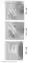 Fig. 161 - Patient-adapted and improved articular implants, designs and related guide tools
