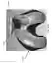 Fig. 167 - Patient-adapted and improved articular implants, designs and related guide tools