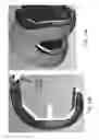 Fig. 183 - Patient-adapted and improved articular implants, designs and related guide tools