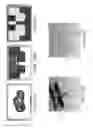 Fig. 196 - Patient-adapted and improved articular implants, designs and related guide tools