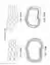 Fig. 202 - Patient-adapted and improved articular implants, designs and related guide tools