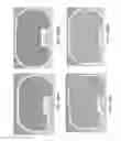 Fig. 203 - Patient-adapted and improved articular implants, designs and related guide tools