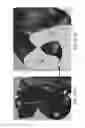 Fig. 205 - Patient-adapted and improved articular implants, designs and related guide tools