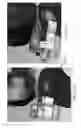 Fig. 210 - Patient-adapted and improved articular implants, designs and related guide tools