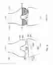 Fig. 22 - Patient-adapted and improved articular implants, designs and related guide tools