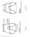 Fig. 33 - Patient-adapted and improved articular implants, designs and related guide tools