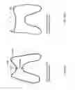 Fig. 34 - Patient-adapted and improved articular implants, designs and related guide tools