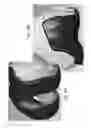 Fig. 40 - Patient-adapted and improved articular implants, designs and related guide tools