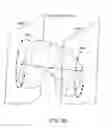 Fig. 48 - Patient-adapted and improved articular implants, designs and related guide tools