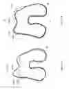 Fig. 53 - Patient-adapted and improved articular implants, designs and related guide tools