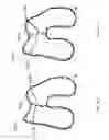 Fig. 55 - Patient-adapted and improved articular implants, designs and related guide tools