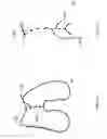 Fig. 56 - Patient-adapted and improved articular implants, designs and related guide tools