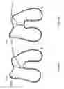 Fig. 57 - Patient-adapted and improved articular implants, designs and related guide tools