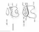 Fig. 65 - Patient-adapted and improved articular implants, designs and related guide tools