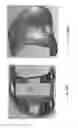Fig. 67 - Patient-adapted and improved articular implants, designs and related guide tools