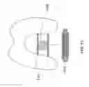 Fig. 69 - Patient-adapted and improved articular implants, designs and related guide tools