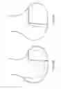 Fig. 72 - Patient-adapted and improved articular implants, designs and related guide tools