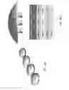 Fig. 86 - Patient-adapted and improved articular implants, designs and related guide tools