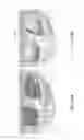 Fig. 89 - Patient-adapted and improved articular implants, designs and related guide tools