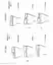 Fig. 94 - Patient-adapted and improved articular implants, designs and related guide tools