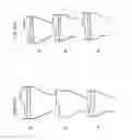Fig. 96 - Patient-adapted and improved articular implants, designs and related guide tools