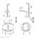 Fig. 12 - RETRIEVAL OF ORTHOPEDIC JOINT DEVICE