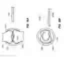 Fig. 15 - RETRIEVAL OF ORTHOPEDIC JOINT DEVICE