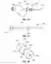 Fig. 23 - RETRIEVAL OF ORTHOPEDIC JOINT DEVICE