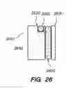 Fig. 24 - RETRIEVAL OF ORTHOPEDIC JOINT DEVICE