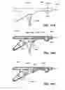 Fig. 30 - RETRIEVAL OF ORTHOPEDIC JOINT DEVICE