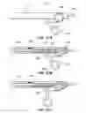 Fig. 32 - RETRIEVAL OF ORTHOPEDIC JOINT DEVICE