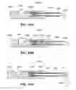 Fig. 35 - RETRIEVAL OF ORTHOPEDIC JOINT DEVICE
