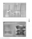 Fig. 06 - Transgenic Animal Model of Cancer and Methods of Use