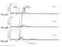 Fig. 07 - Laundry treating appliance with tumble pattern control