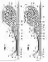 Fig. 02 - Cording restraining means attachable to a tool