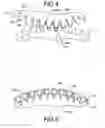 Fig. 04 - Engine scissor gear assembly