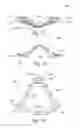 Fig. 41 - Mask system