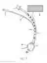 Fig. 02 - System and method for imaging endotracheal tube placement and measuring airway occlusion cuff pressure