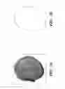 Fig. 02 - Orthotic device for preventing and/or correcting deformational posterior plagiocephaly