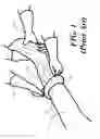 Fig. 02 - Stockinette having folded structure for simplified application