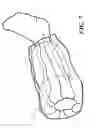 Fig. 07 - Stockinette having folded structure for simplified application