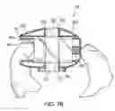 Fig. 09 - Vaporizer system for delivery of inhalable substances